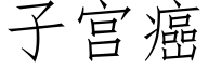 子宫癌 (仿宋矢量字库)