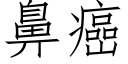 鼻癌 (仿宋矢量字库)