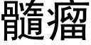 髓瘤 (黑体矢量字库)