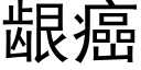 龈癌 (黑體矢量字庫)