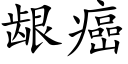龈癌 (楷體矢量字庫)